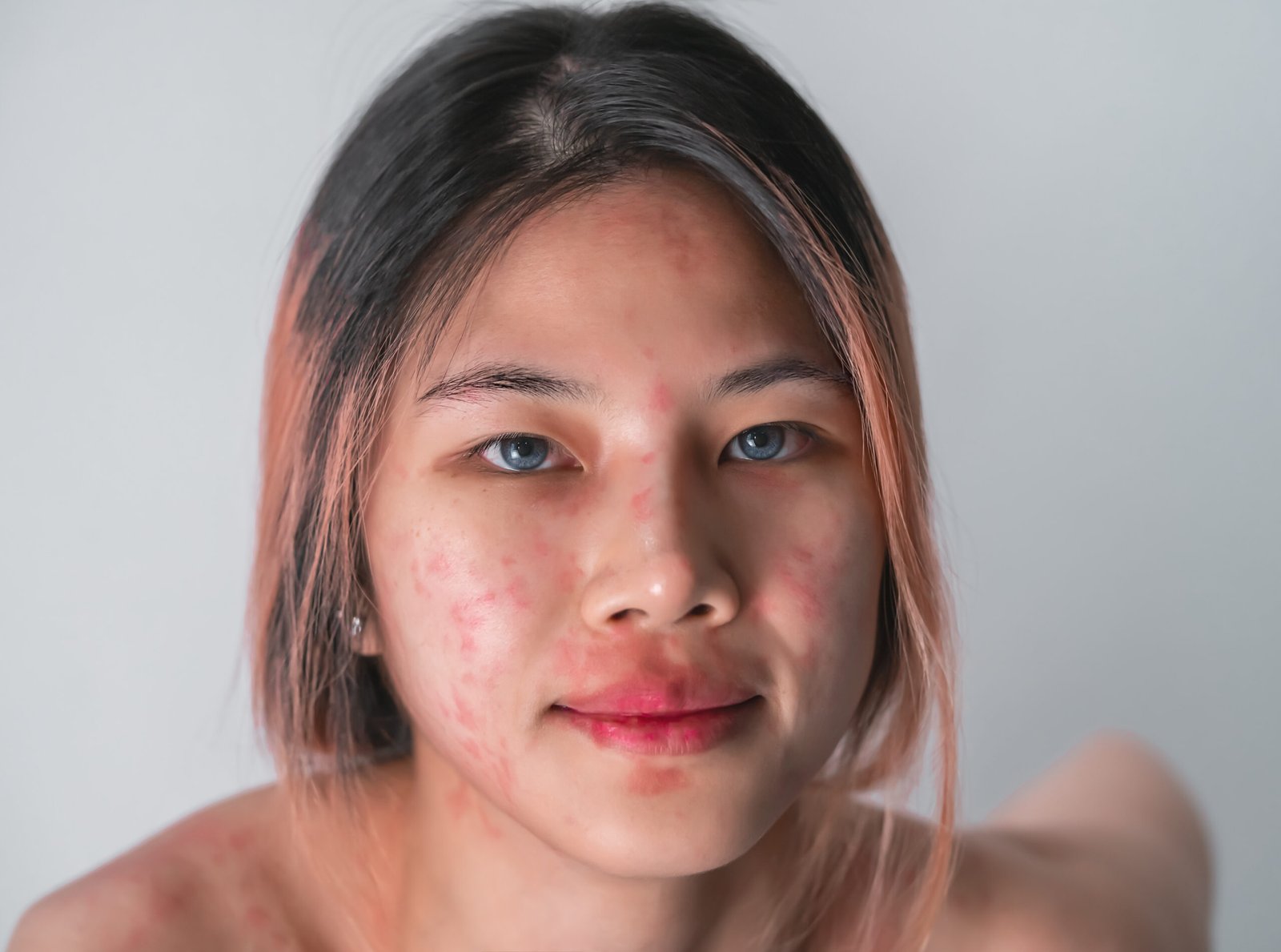 How to Fix the 6 Most Common Skin Care Problems