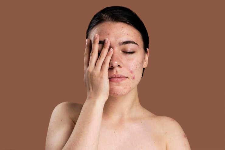 8 Signs Of Unhealthy Skin
