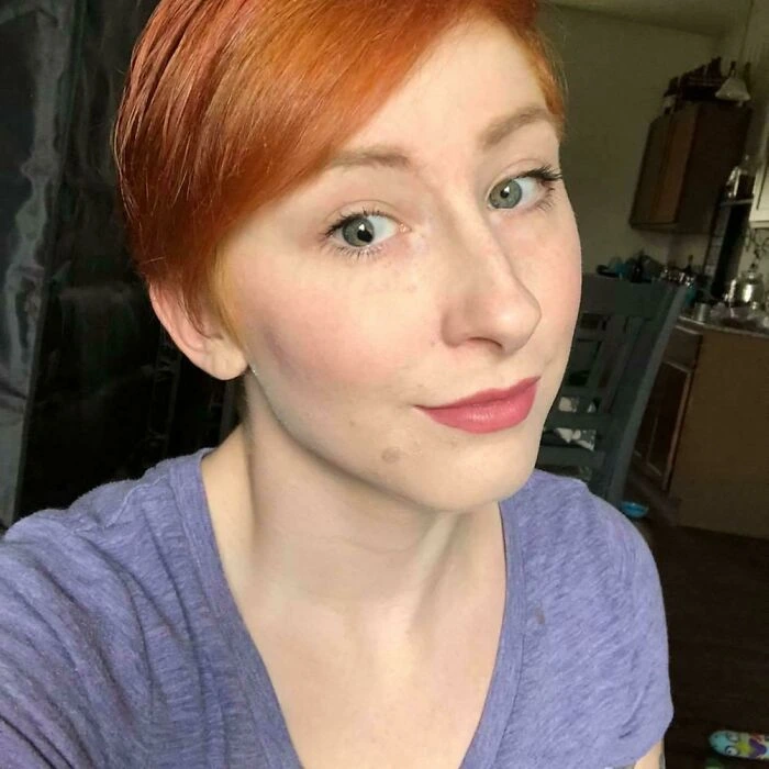 Pear-Shaped Pupil