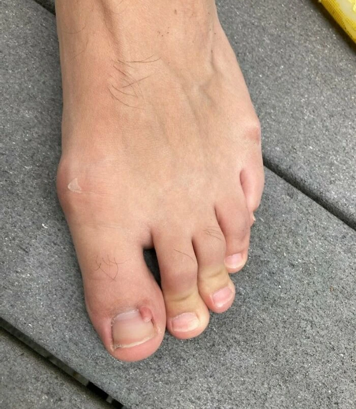 This Toe
