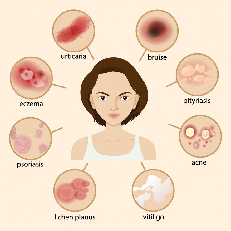 What Are The Symptoms Of Skin Cancer?